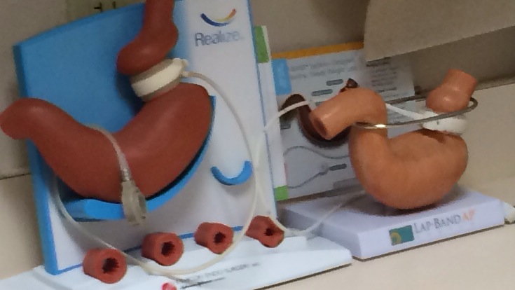 Banda gástrica ajustable