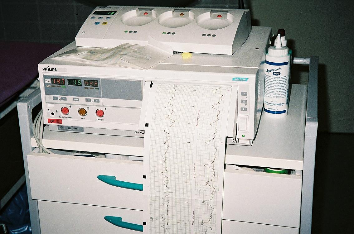 Cardiotocògraf (monitor fetal)