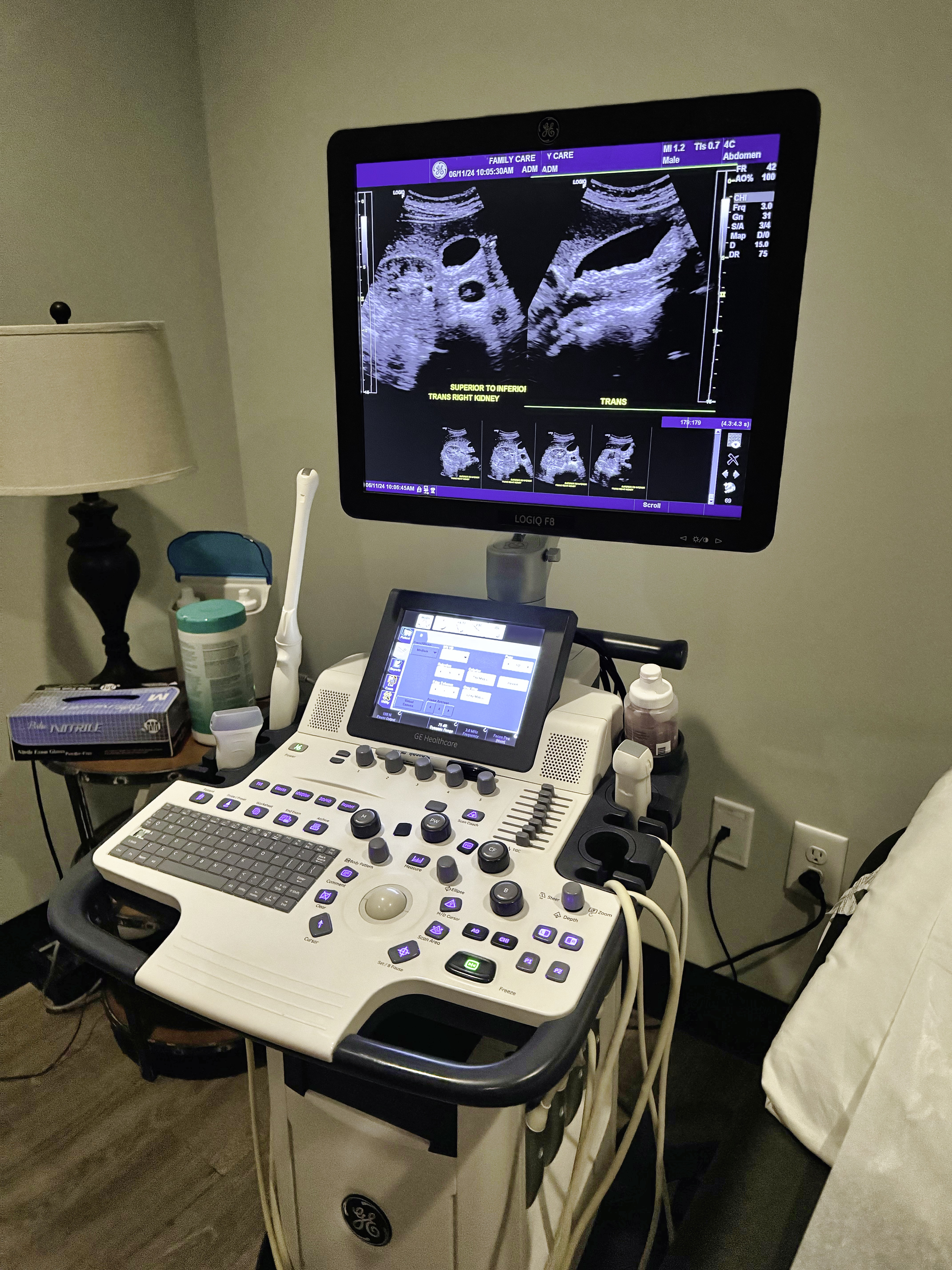 Portable ultrasound machine for regional anesthesia